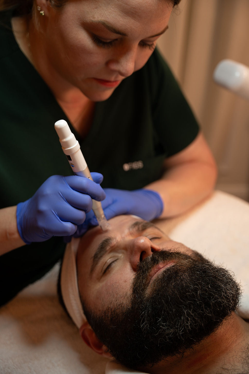 Microneedling with AnteAGE