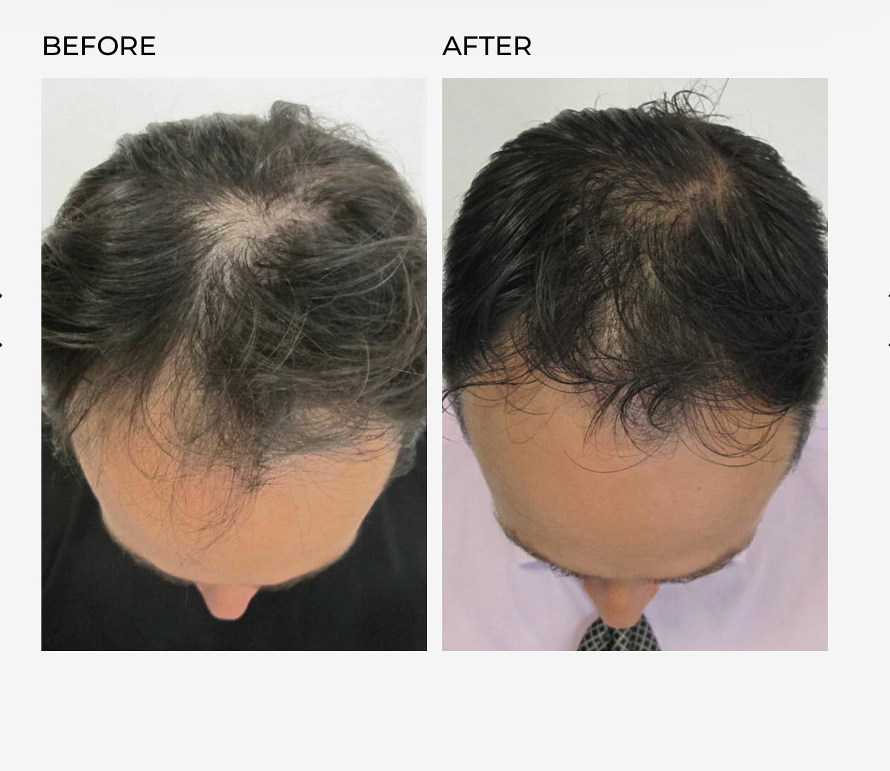 Deeply Rooted Hair Serum