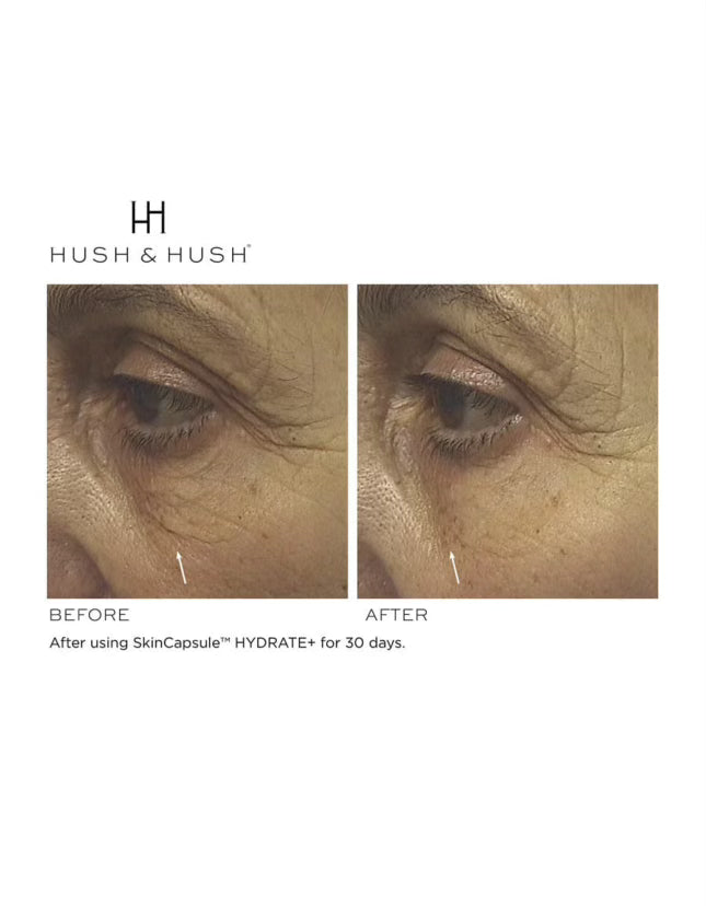 Skin Capsule HYDRATE+