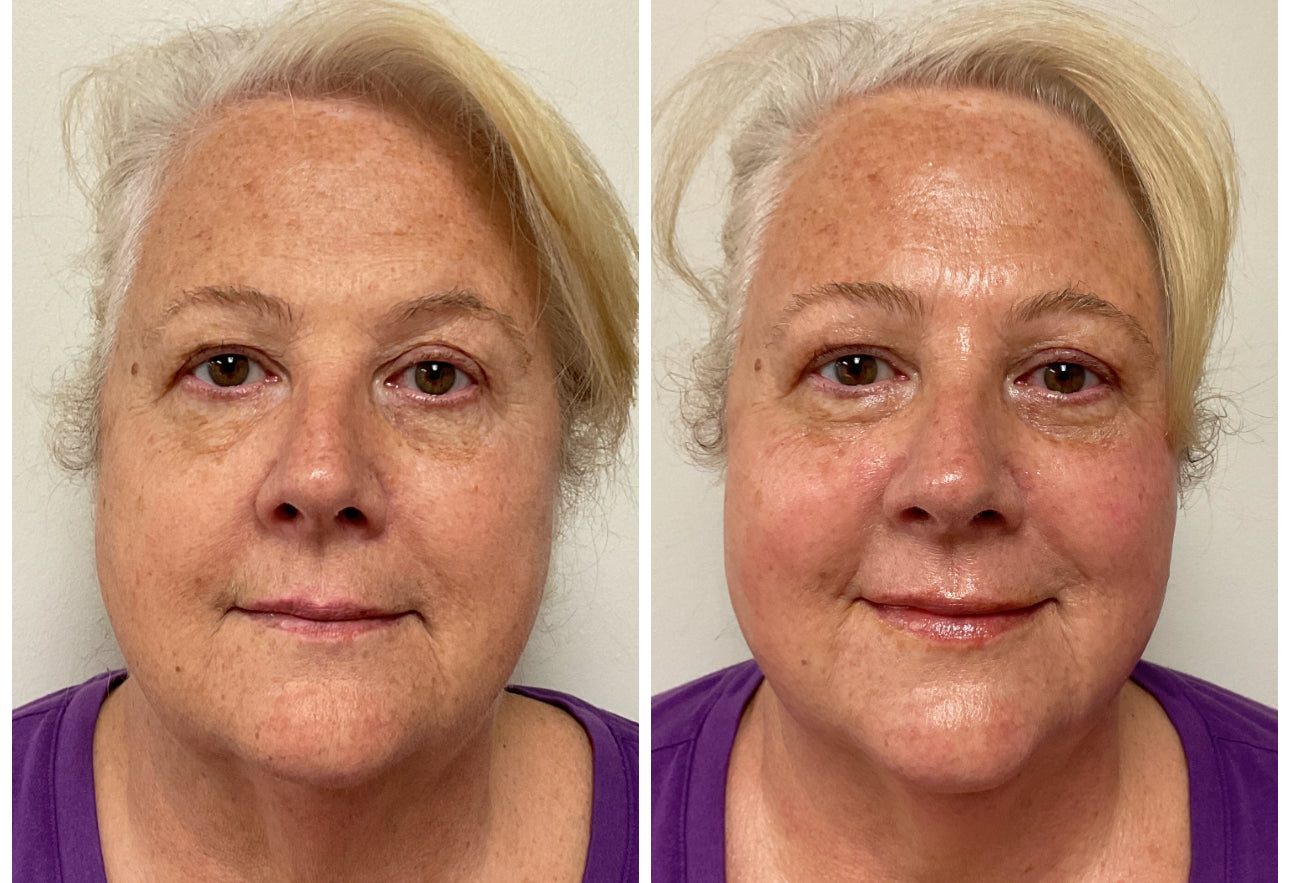 Fascia Sculpt & Glow Facial