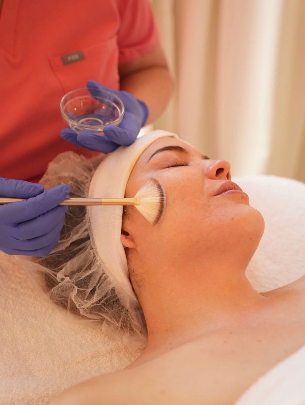 Chemical Peels