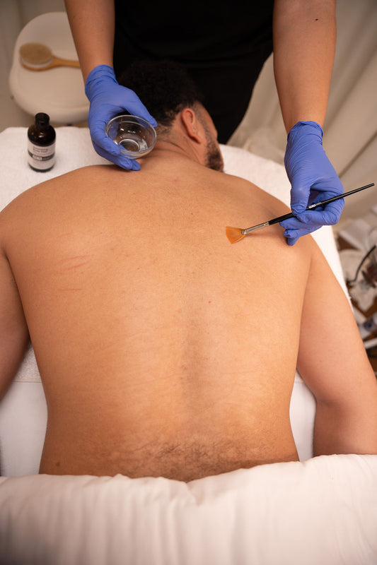 Body Peel