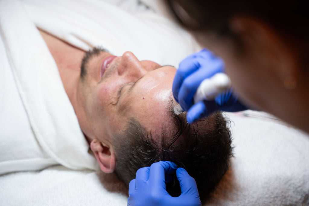 Gloved practitioner uses a pen-shaped treatment device at a person’s hairline.