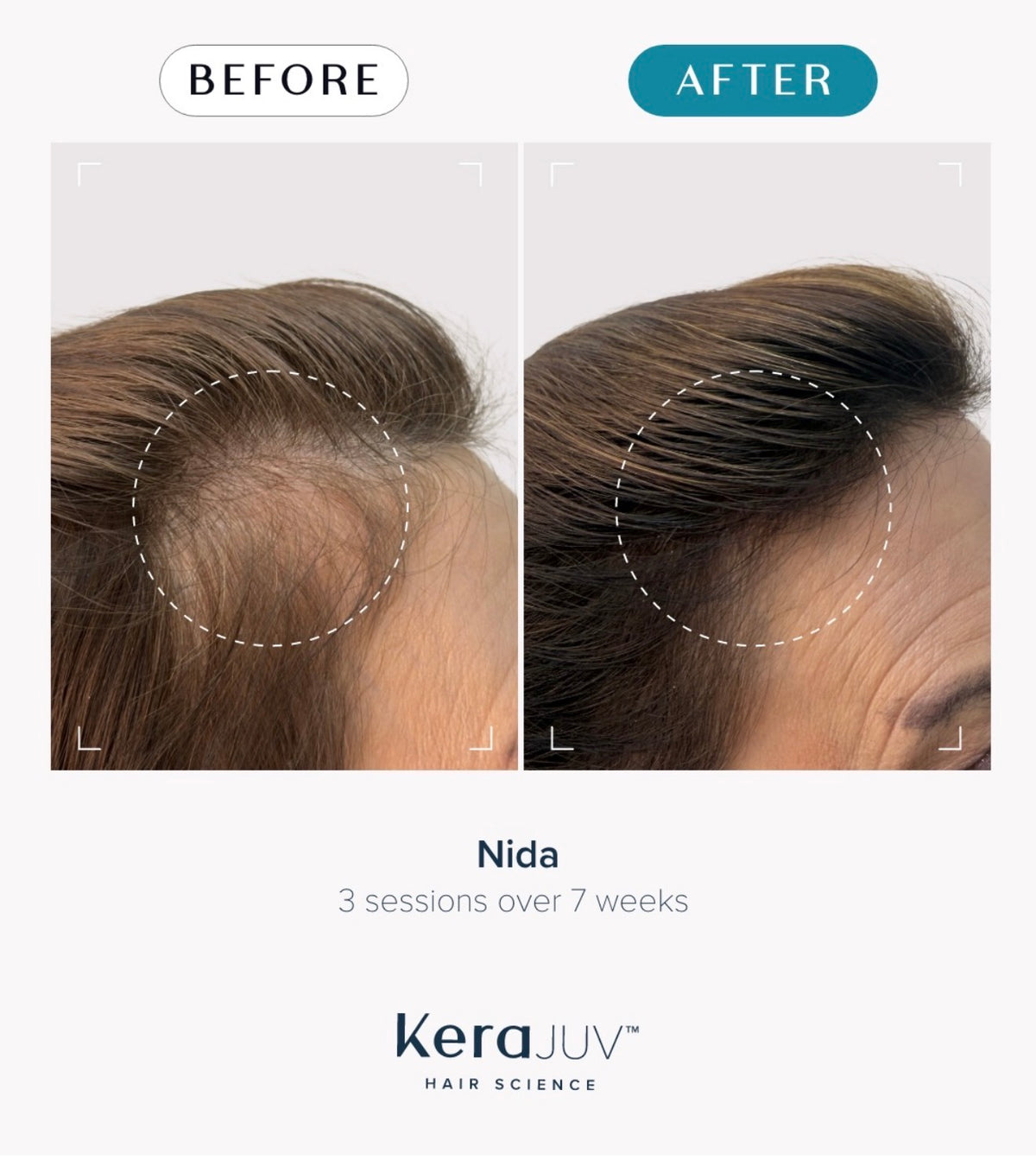 Hair & Scalp Therapy