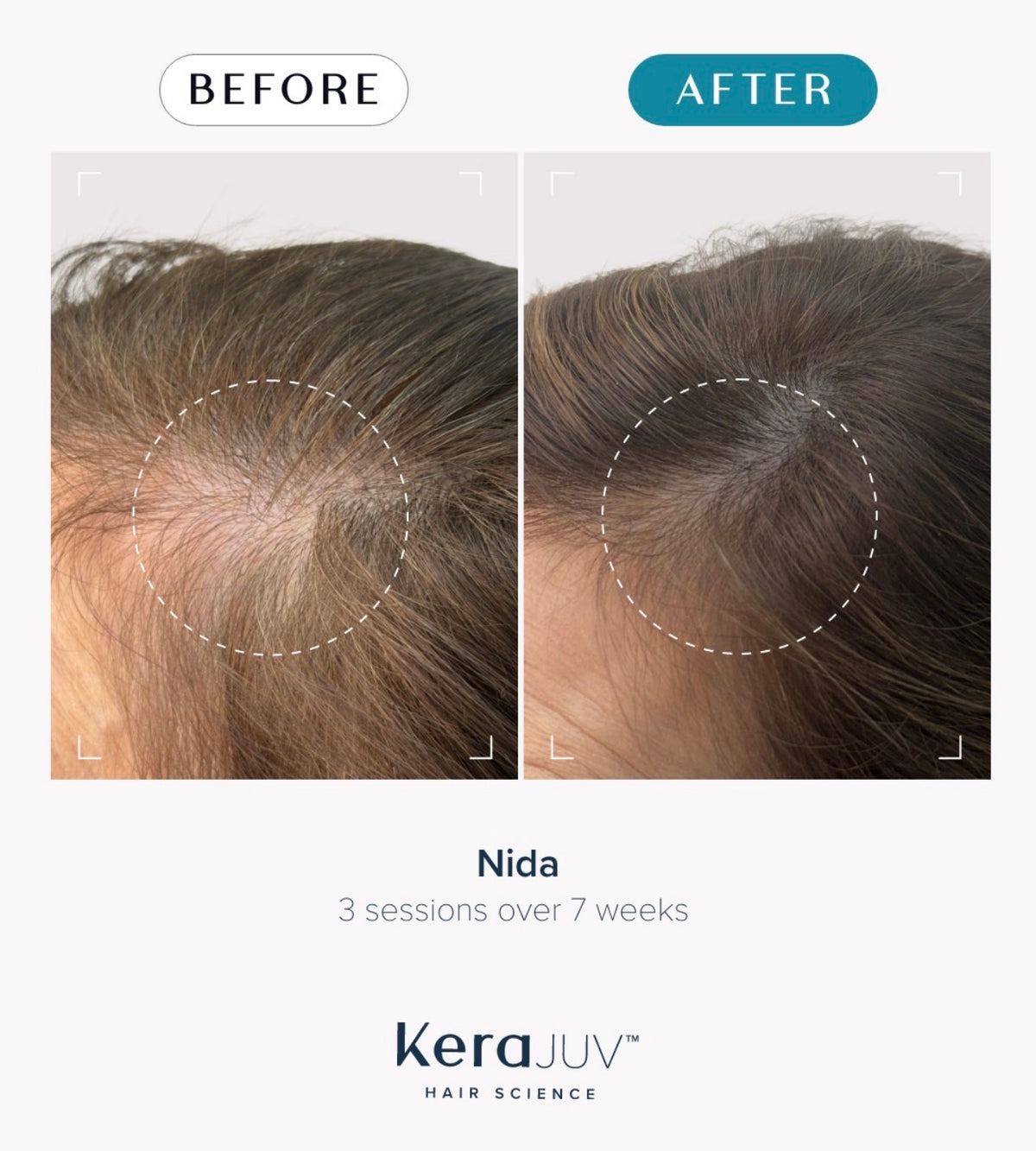 Hair & Scalp Therapy