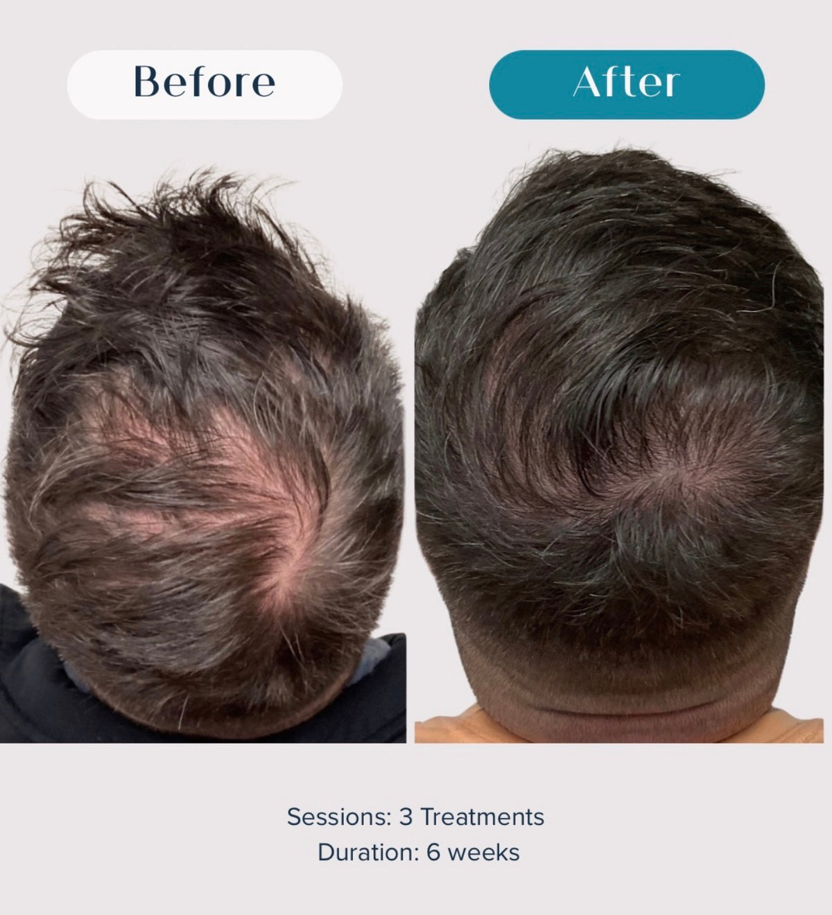 Hair & Scalp Therapy