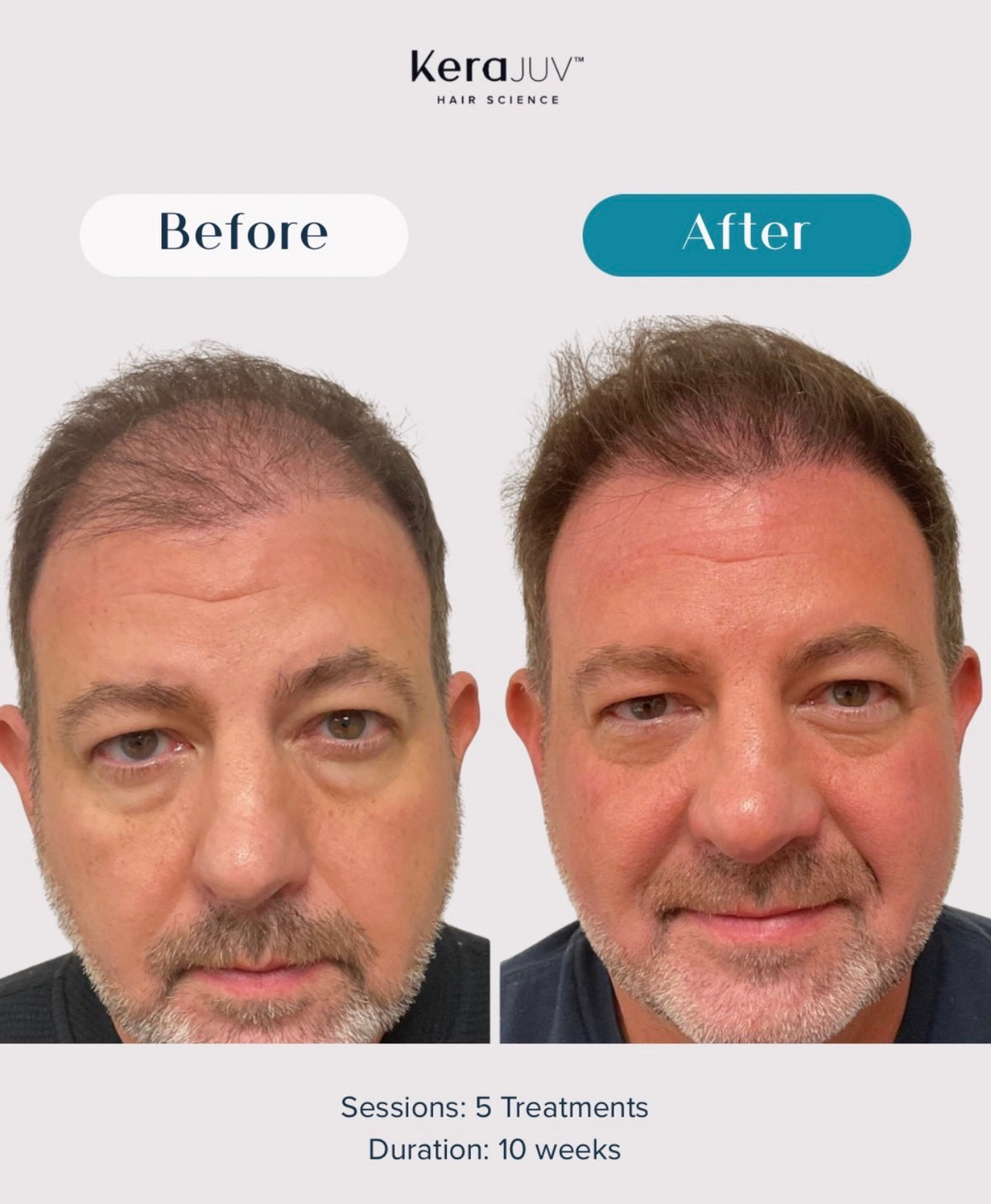 Hair & Scalp Therapy