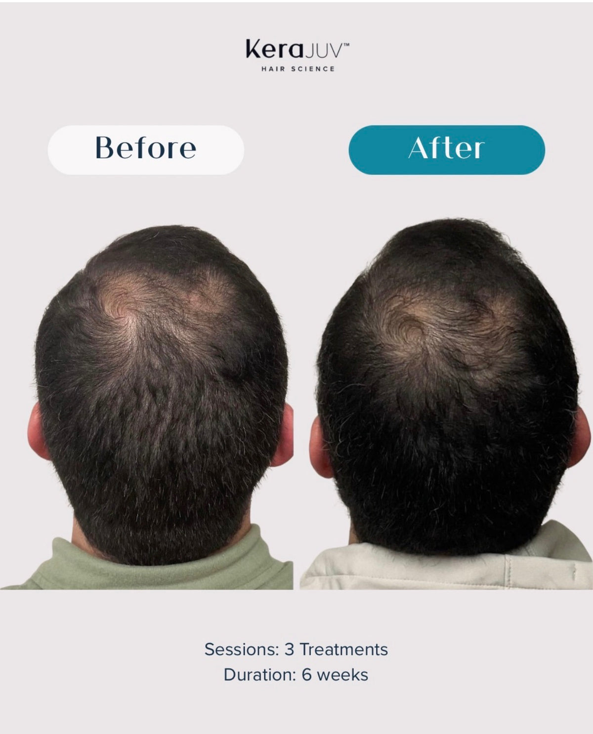 Hair & Scalp Therapy