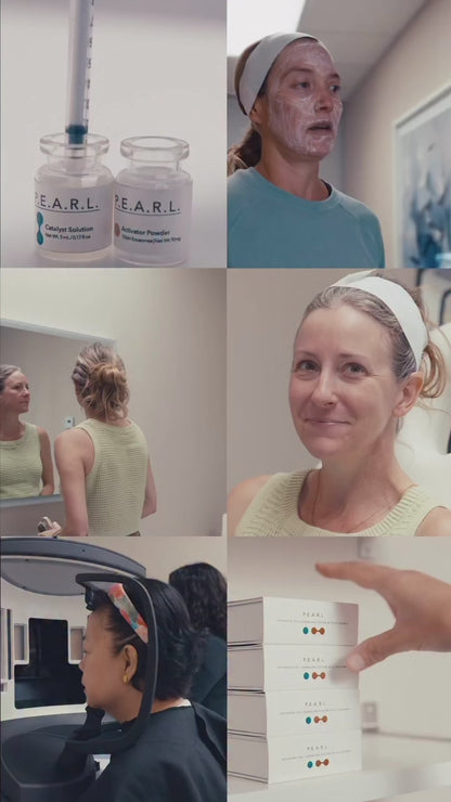 Microneedling with AnteAGE P.E.A.R.L